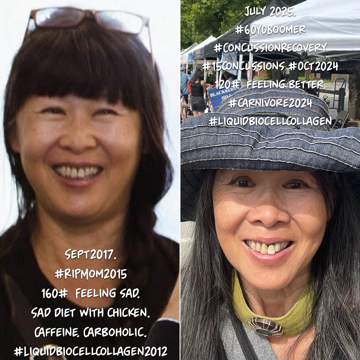 CollagenBabe's tweet image. Sept2017. 
160#  Sad diet with chicken. 
#Liquidbiocellcollagen2012 

July 2025. 
#60YOBoomer 
#ConcussionRecovery   
#15concussions #Oct2024 
120#  feeling better with 
#liquidbiocellcollagen
#carnivore2024 

RespectfullyMoneca 
CollagenBabe 
Biohacker 
🙏🧠❤️🥩🇨🇦✨💃🏻💋