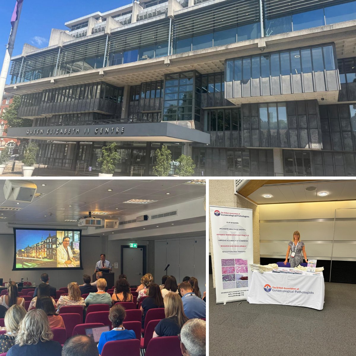 BAGPGynPath's tweet image. Great turnout for the morning GynaePath session during the @BGCS_org Annual Scientific Meeting at QEII, London! Fantastic discussions! Thank you to everyone who joined! #GynaePath