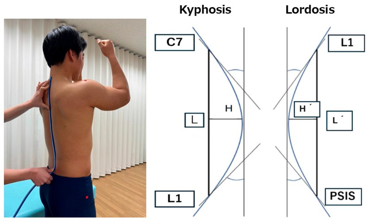 📢🆕 Newly published article: Akao et al. examine the association between spinopelvic alignment and muscle shortening, focusing on thoracic kyphosis, lumbar lordosis, and anterior pelvic tilt.

🔗Read more at: brnw.ch/21wU2wl

#Posture #Spinal #OpenAccess #MDPI