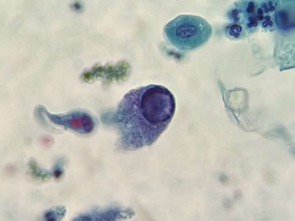 Nice example of decoy cell.