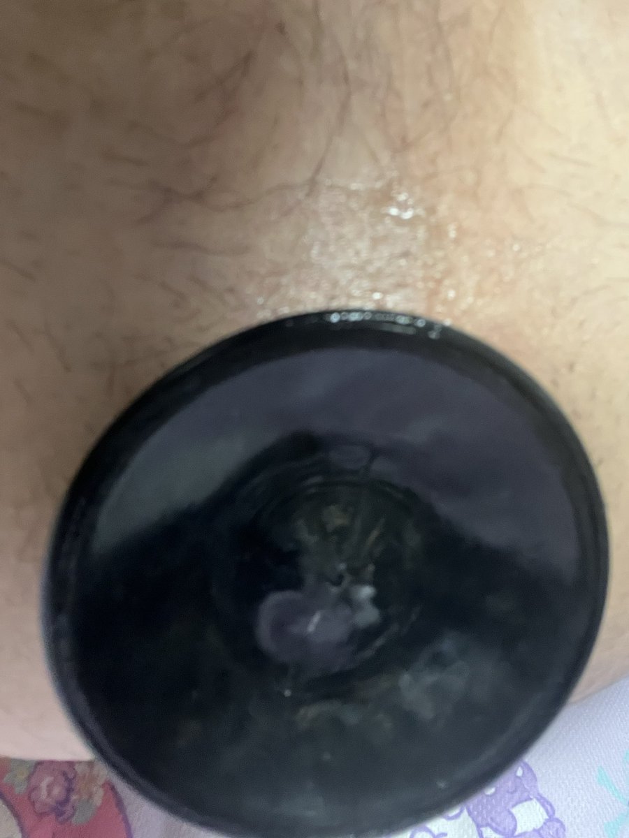 ANAL__ZONE's tweet photo. 2時間以上バットプラグ入れっぱなしで拡張中！夏は暑いから括約筋をほ��しやすく挿入が楽で捗る🅐🅝🅐🅛
#アナル拡張 https://t.co/rdS5TxPy1O