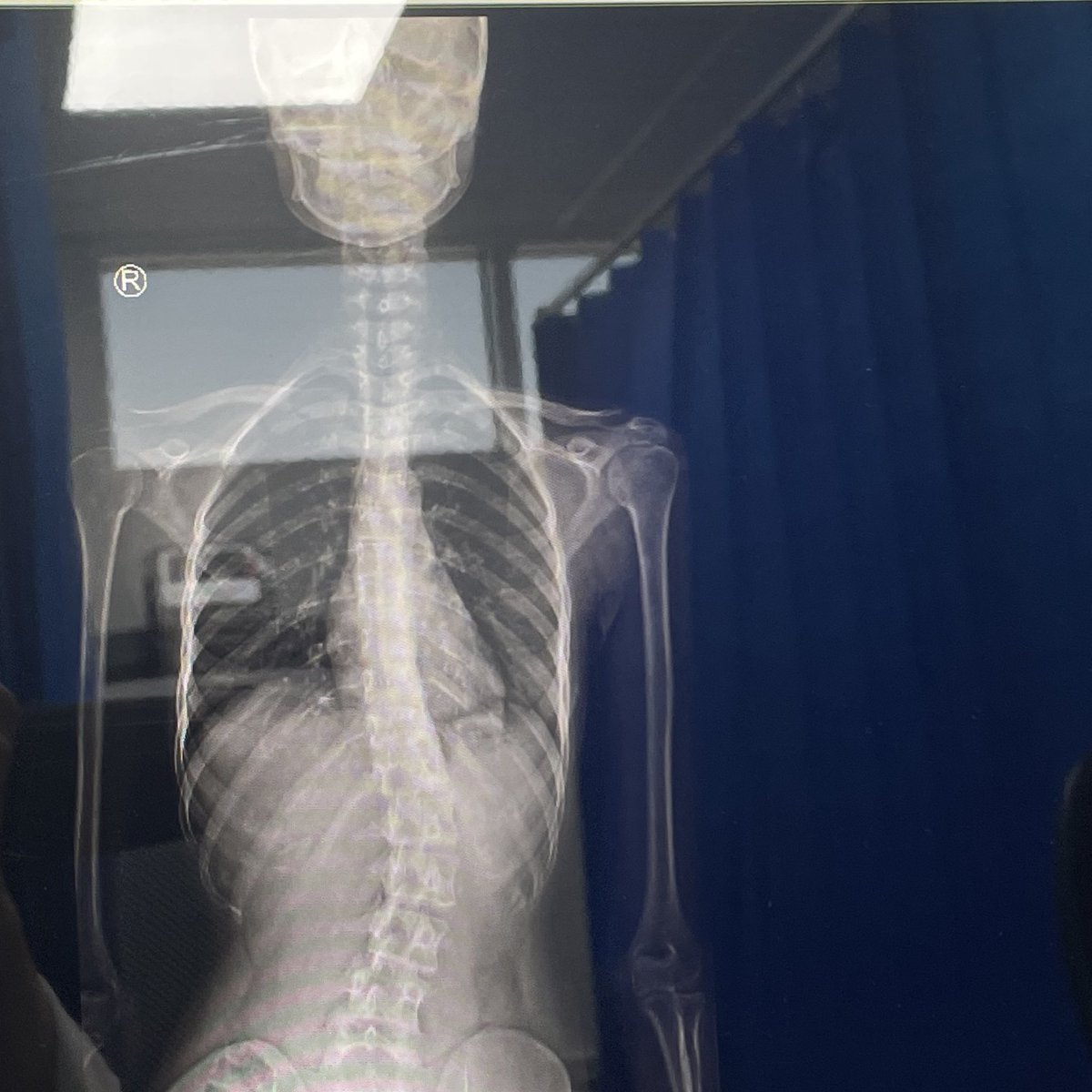 2 weeks of internship so far