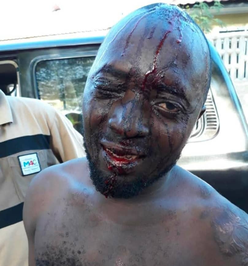 Haya ndiyo maisha yetu na ngeu ndiyo staili zetu ktk siasa zetu za kila siku..!

Alafu Kuna MPUMBAVU unakuta kala viazi kazimbiwa hana hata Kovu moja kuanzia utosini hadi Kidoleni chini ila leo anaigiza ushujaa wa kutufundisha kulinda kura..?