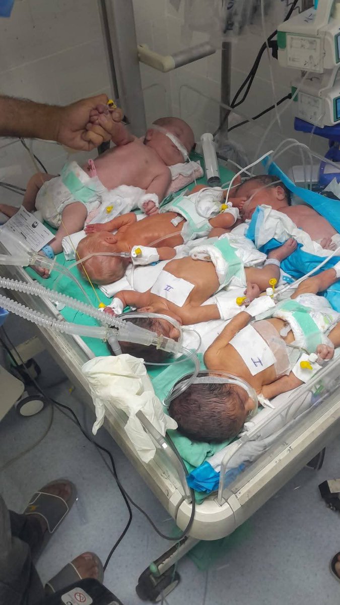 Gazze Şifa Hastanesi’nde yeni doğan bebeklerin kuvözdeki durumu. 

İşgalci İsrail güçleri hastanelere yakıt girişini engellemeye devam ederse bir süre sonra jeneratörler çalışmayı durduracak, dünyaya gözlerini yeni açan bebekler hayati tehlike altında kalacak.