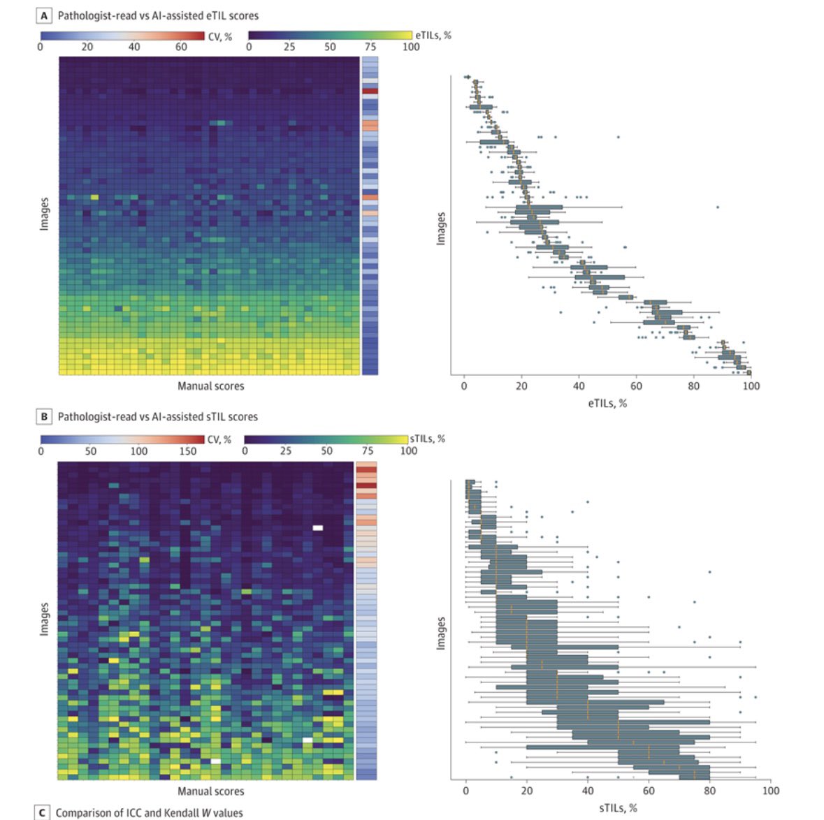 David Su (@davidsumd) on Twitter photo AI is reshaping digital oncopathology.
Our multi-institutional study in <a href="/JAMANetworkOpen/">JAMA Network Open</a> shows an in-house AI model outperforms traditional methods in quantifying TILs in melanoma.
Congrats to Thazin Aung, Matt Liu, <a href="/DavidRimm/">روبي♥</a>
@YalePathology <a href="/YaleCancer/">Yale Cancer Center</a>
🔗 tinyurl.com/AITILMEL AI is reshaping digital oncopathology.
Our multi-institutional study in <a href="/JAMANetworkOpen/">JAMA Network Open</a> shows an in-house AI model outperforms traditional methods in quantifying TILs in melanoma.
Congrats to Thazin Aung, Matt Liu, <a href="/DavidRimm/">روبي♥</a>
@YalePathology <a href="/YaleCancer/">Yale Cancer Center</a>
🔗 tinyurl.com/AITILMEL