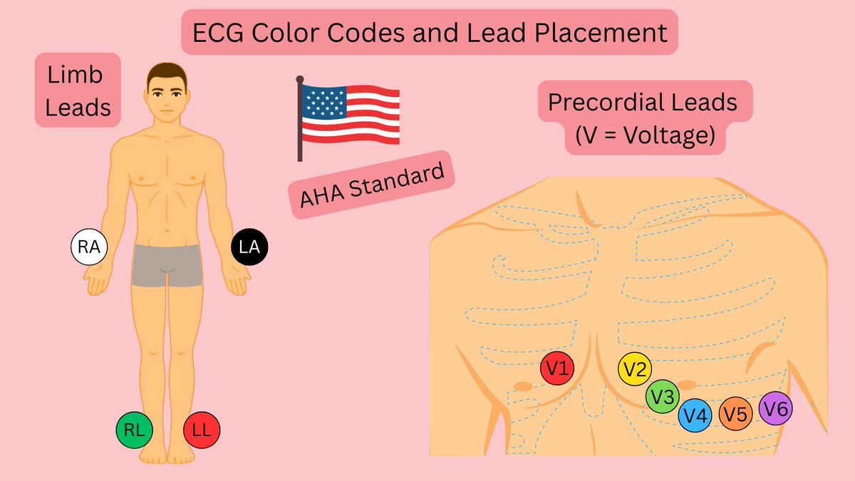 ECGsmart tweet media