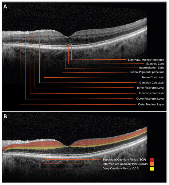 NMOphthalmology's tweet image. 🚨 PUBLICATION ALERT 🚨
Retinal Imaging as a Window into Cardiovascular Health: Towards Harnessing Retinal Analytics for Precision Cardiovascular Medicine
Authors included: Rukhsana Mirza, MD (@rg_mirza)
Article Link: mdpi.com/2308-3425/12/6…