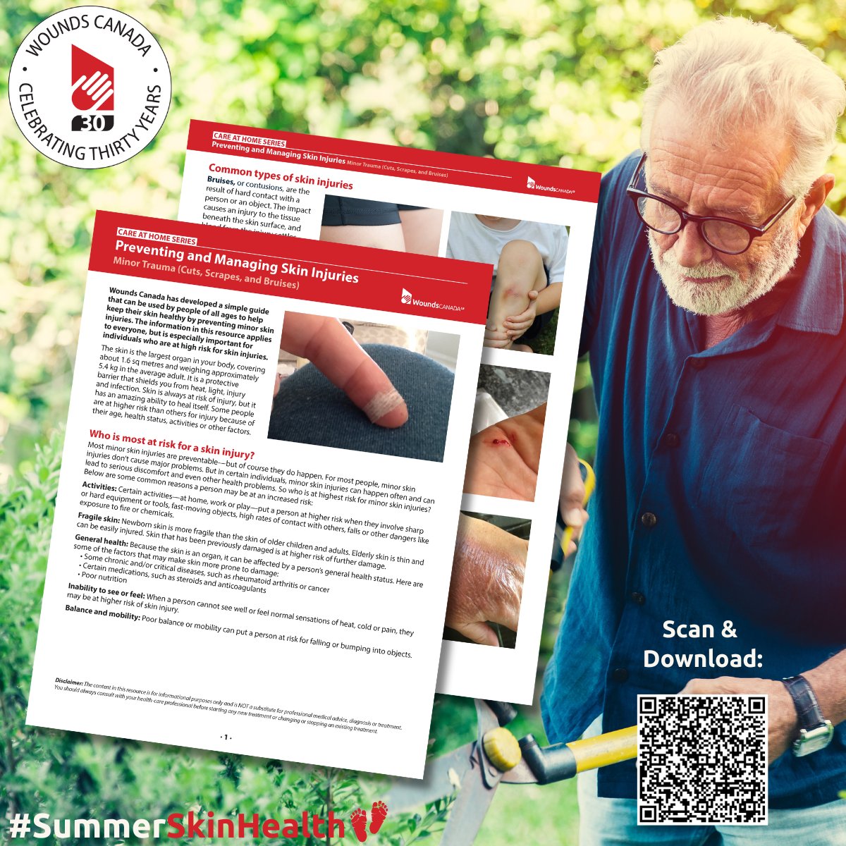 🌿 Your backyard can be a relaxing oasis—but safety comes first!

Whether you're mowing the lawn or trimming branches, taking a few precautions can help you prevent injuries and protect your skin.

ow.ly/FbYn50WnOuc