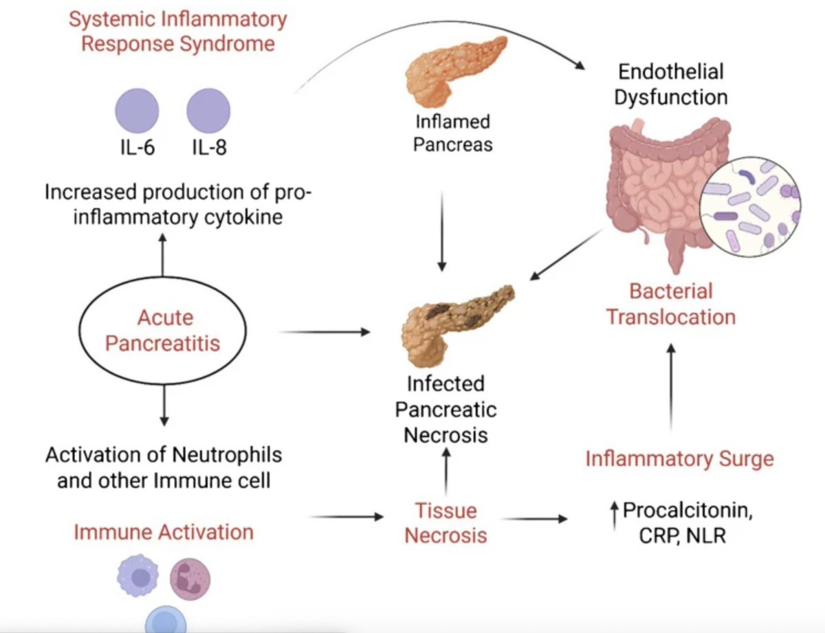 IJG_Journal's tweet image. MUST READ

Diagnosis of infected pancreatic necrosis: A review of the role of blood biomarkers

Niharika Dutta, Pankaj Gupta et al

#GITwitter

link.springer.com/article/10.100…