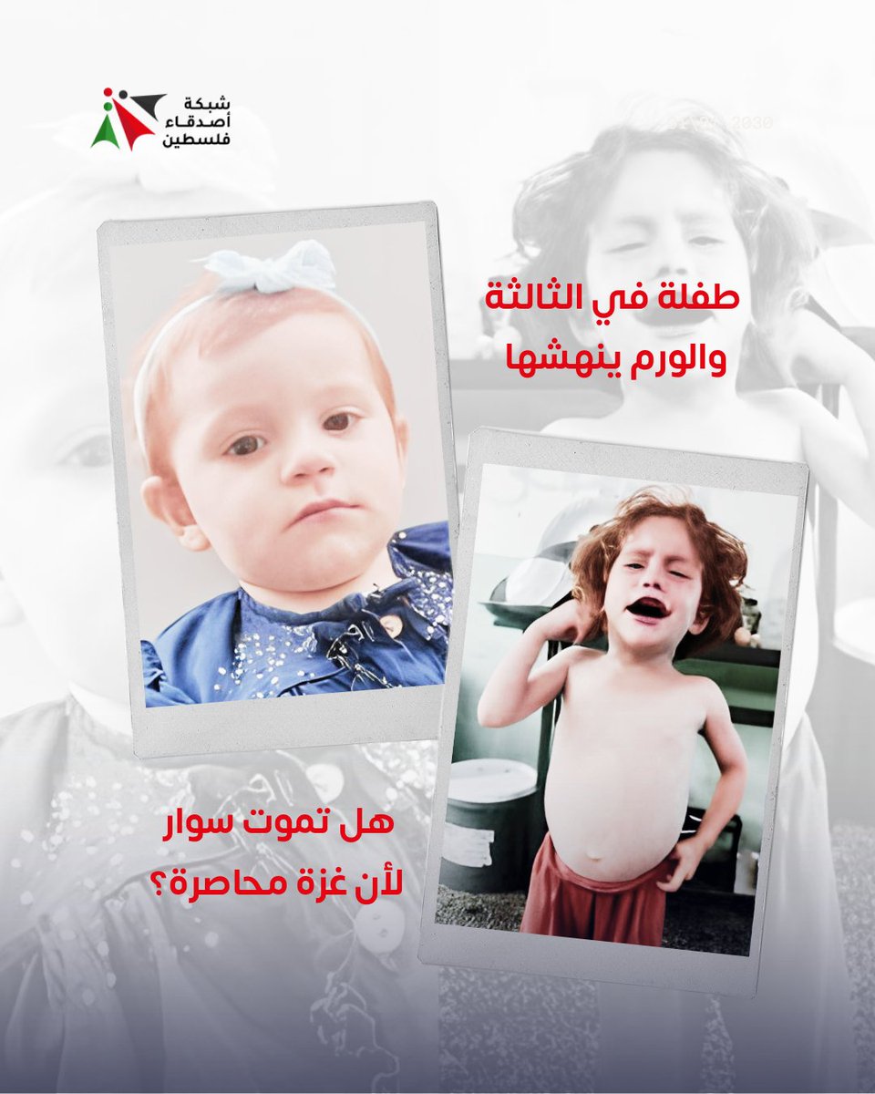 ترقد الطفلة سوار أبو طبيخ، الصغيرة بين الحياة والموت، جسدها الهزيل لا يحتمل المرض بينما ينتشر الورم في أحشائها أمام أعين والديها، في ظل حصار إسرائيلي مفروض على #غزة، لا دواء ولا أمل.فقط طفلة تتألم بصمت، وتنتظر من يسمع أنينها. 
سوار تحتاج للسفر العاجل، فلماذا يمنع الاحتلال سفرها؟.