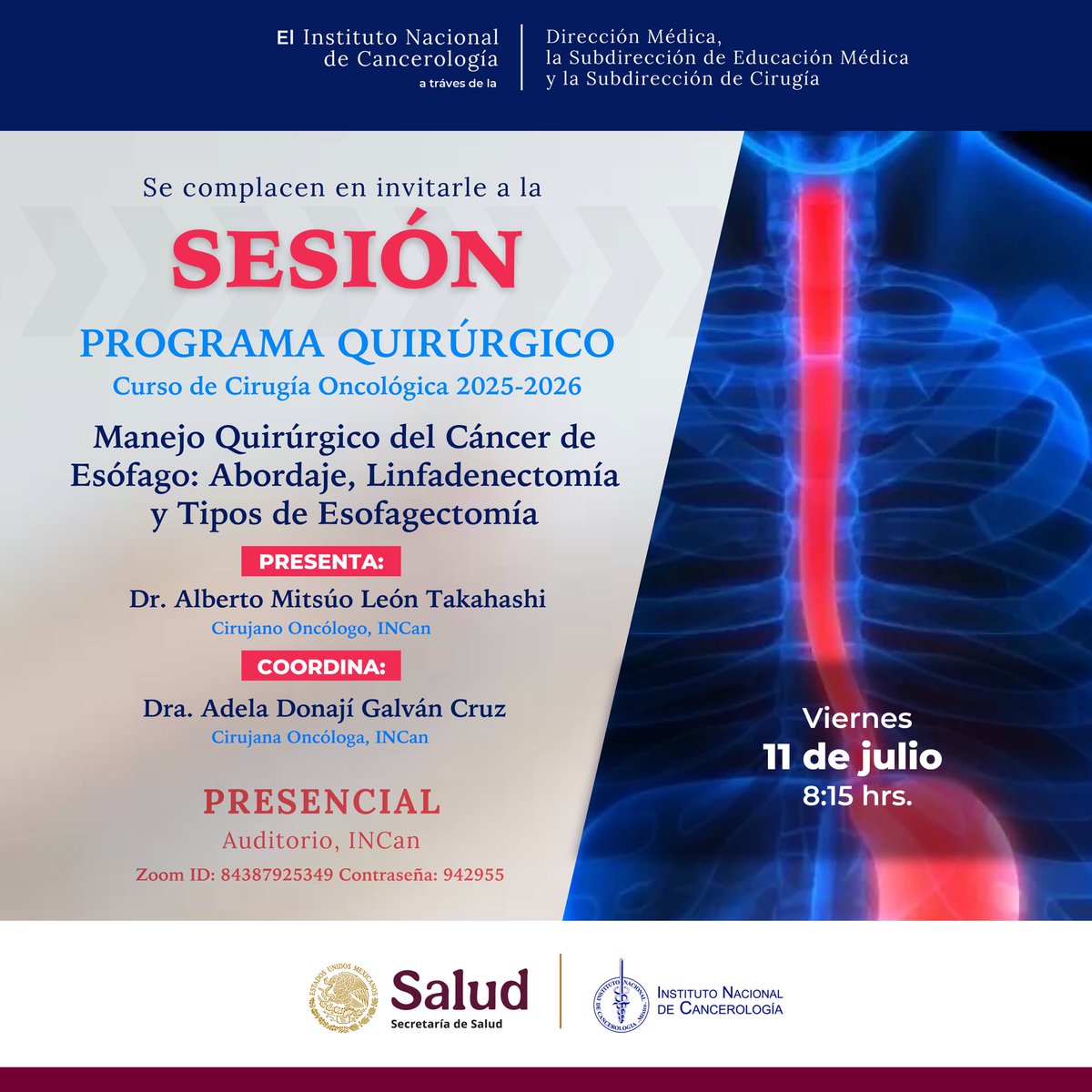 incanMX's tweet image. 🔵 ¡Te invitamos a la próxima Sesión del Programa Quirúrgico del Curso de Cirugía Oncológica 2025-2026!
📌 Manejo Quirúrgico del Cáncer de Esófago: Abordaje, Linfadenectomía y Tipos de Esofagectomía
📍 Auditorio INCan | 💻 También por Zoom
📅 Viernes 11 de julio
🕗 8:15 h