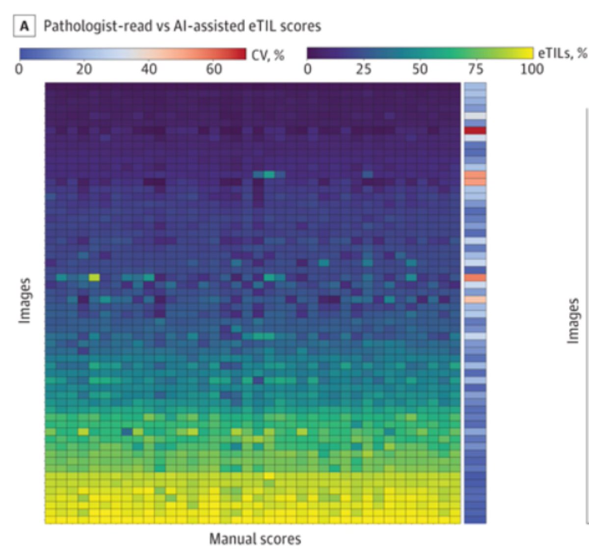 Yale Pathology (@yalepathology) on Twitter photo New study from <a href="/YaleMed/">Yale School of Medicine</a> & <a href="/YaleCancer/">Yale Cancer Center</a> led by <a href="/tznaung/">Thazin Nwe Aung, PhD</a> shows that AI-based scoring of tumor-infiltrating lymphocytes in #melanoma significantly outperforms the traditional method. bit.ly/40aGbuO New study from <a href="/YaleMed/">Yale School of Medicine</a> & <a href="/YaleCancer/">Yale Cancer Center</a> led by <a href="/tznaung/">Thazin Nwe Aung, PhD</a> shows that AI-based scoring of tumor-infiltrating lymphocytes in #melanoma significantly outperforms the traditional method. bit.ly/40aGbuO