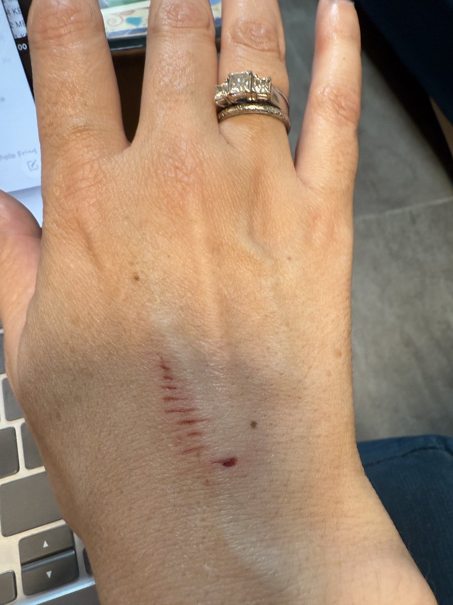 abbiperets's tweet image. At the doctor's office today for my shoulder, the doctor told me to put my arms out to the sides, whereupon I of course slammed my hand into the paper towel dispenser.
Doc: OH MY GOD ARE YOU OKAY?
Me: Yeah, I'm fine.
Exam continues. I explain that my shoulder REALLLLLLLY…