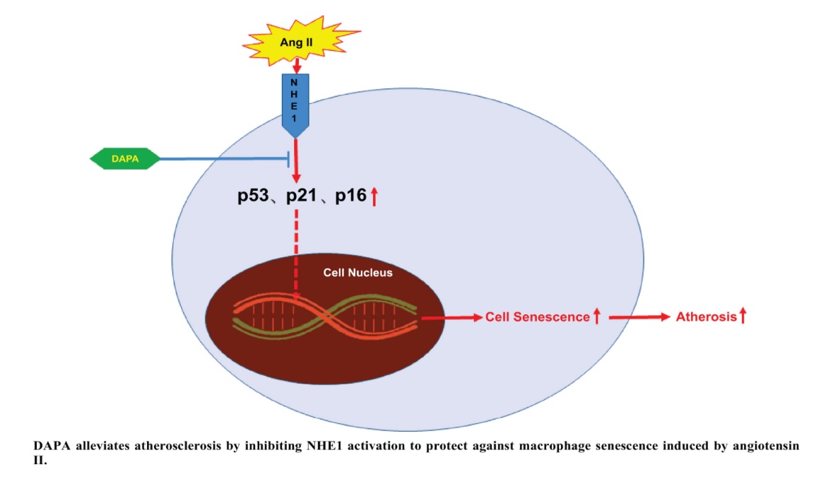 SGLT2i Alleviates Atherosclerosis by Inhibiting NHE1 Activation to Protect against Macrophage Senescence Induced by Angiotensin II

eurekaselect.com/article/140615