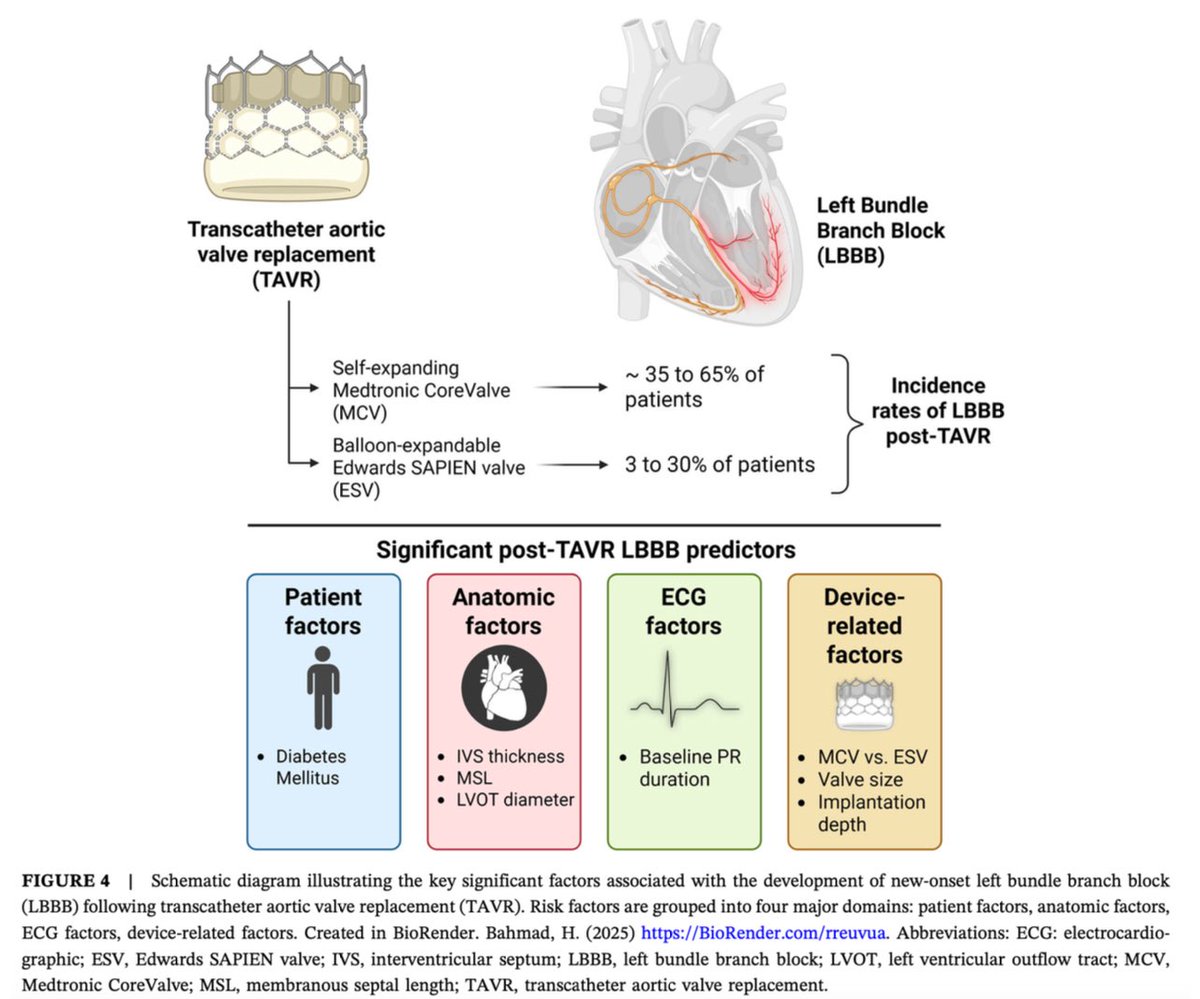 DrTcard's tweet image. 🚨 New publication!
We just published a meta-analysis on predictors of post-TAVR LBBB —a complication still surrounded by uncertainty. Our study brings some clarity by summarizing key predictors from 6,000+ patients. onlinelibrary.wiley.com/doi/10.1111/jc…
#TAVR #CardioTwitter #EPeeps #LBBB