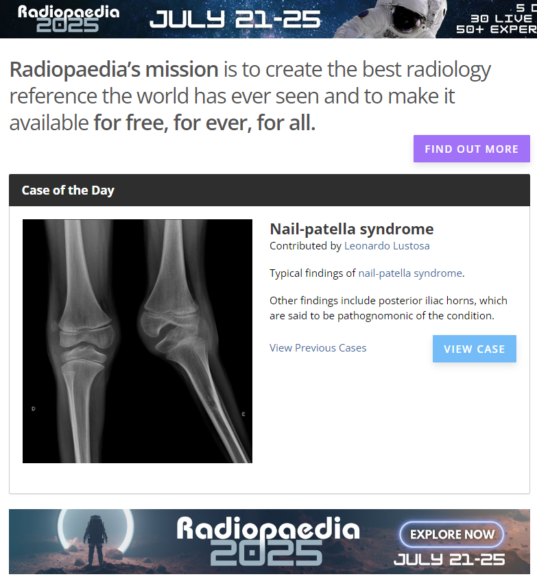 Leonardo Lustosa 𦴠(@drleolustosa) on Twitter photo Nice to have another case shared on <a href="/Radiopaedia/">Radiopaedia.org</a>'s homepage. Nail-patella syndrome is a rare condition. Check the case to learn more about it:
πradiopaedia.org/cases/198697 Nice to have another case shared on <a href="/Radiopaedia/">Radiopaedia.org</a>'s homepage. Nail-patella syndrome is a rare condition. Check the case to learn more about it:
πradiopaedia.org/cases/198697