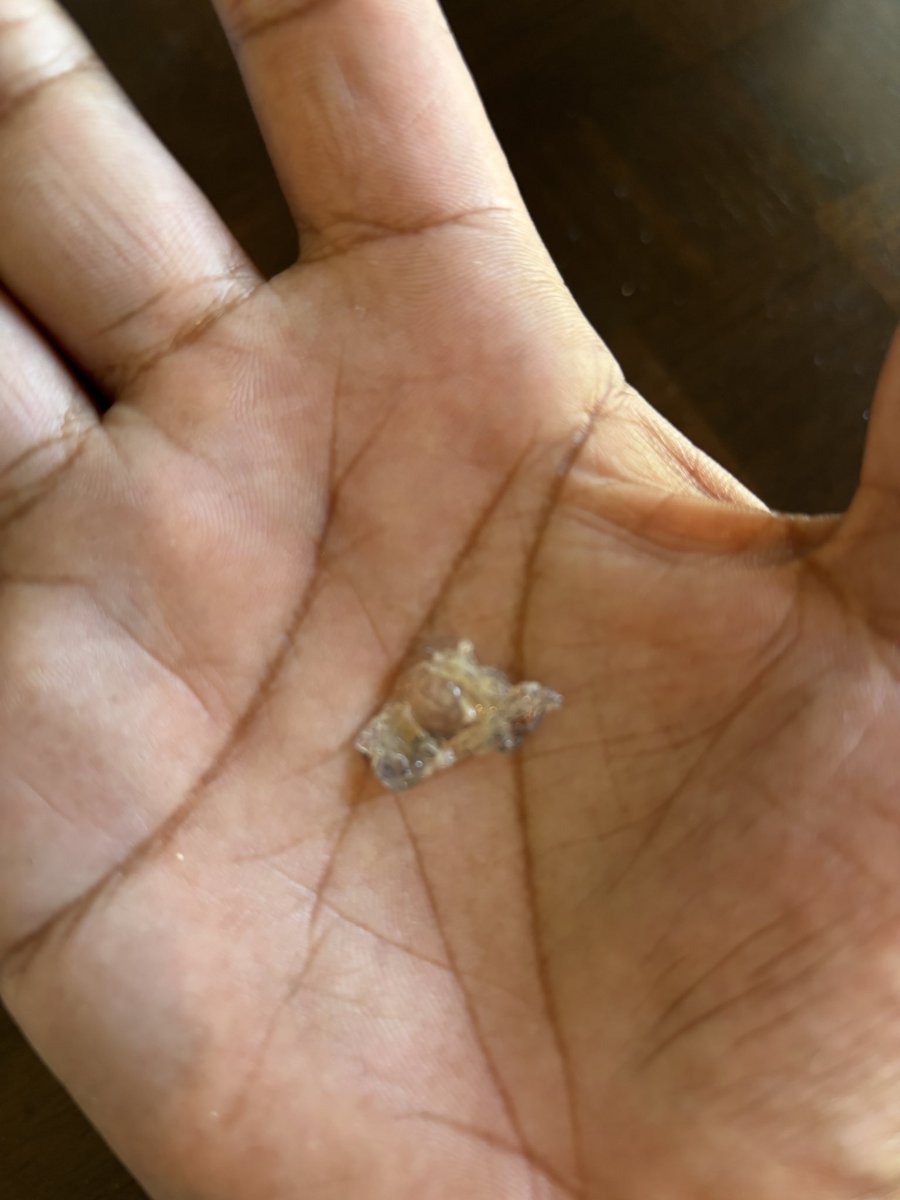 itz_cap_ttv's tweet photo. @PandaExpress found burnt plastic in my food when I ordered from the Atwater, Ca location. At least that’s what I hope it is. 🤢 https://t.co/se0aBCc0c6
