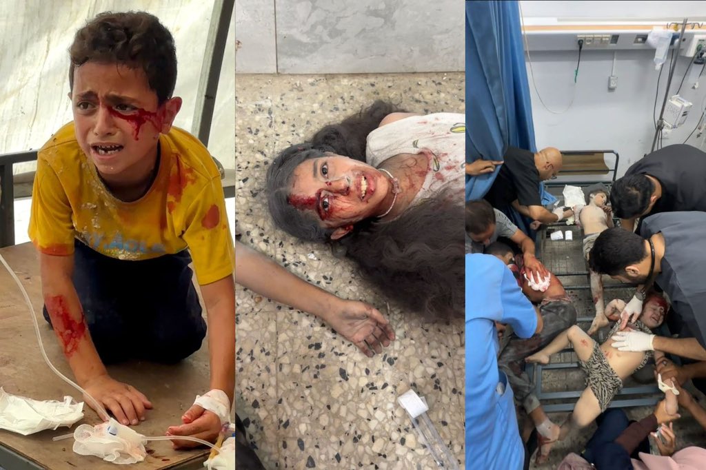 nahed_hajjaj99's tweet image. I covered two hospitals today. Al Ahli and Al Shifa. It was as if I went to the same hospital. The exact same scenes. Bloody children on the floor. some breathing, some dead. Some with limbs. Some without.
We are being eradicated as a people, live streamed, and the world watches