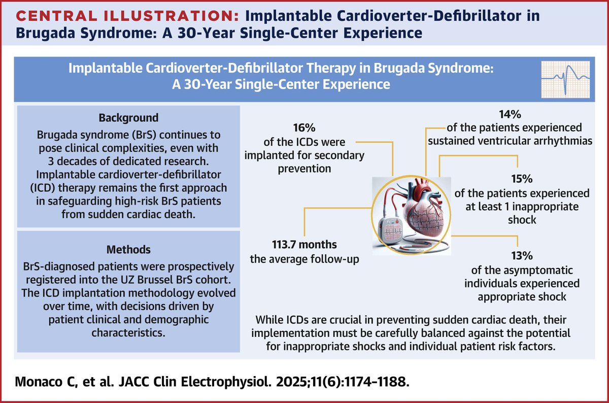 #JACCCEP study highlights ICDs critical role in preventing fatal arrhythmias in BrS but had frequent complications, especially in younger pts. Thoracoscopic epicardial ablation reduced VA burden in high-risk cases &amp; shows promise as adjunct therapy jacc.org/doi/10.1016/j.… #epICD