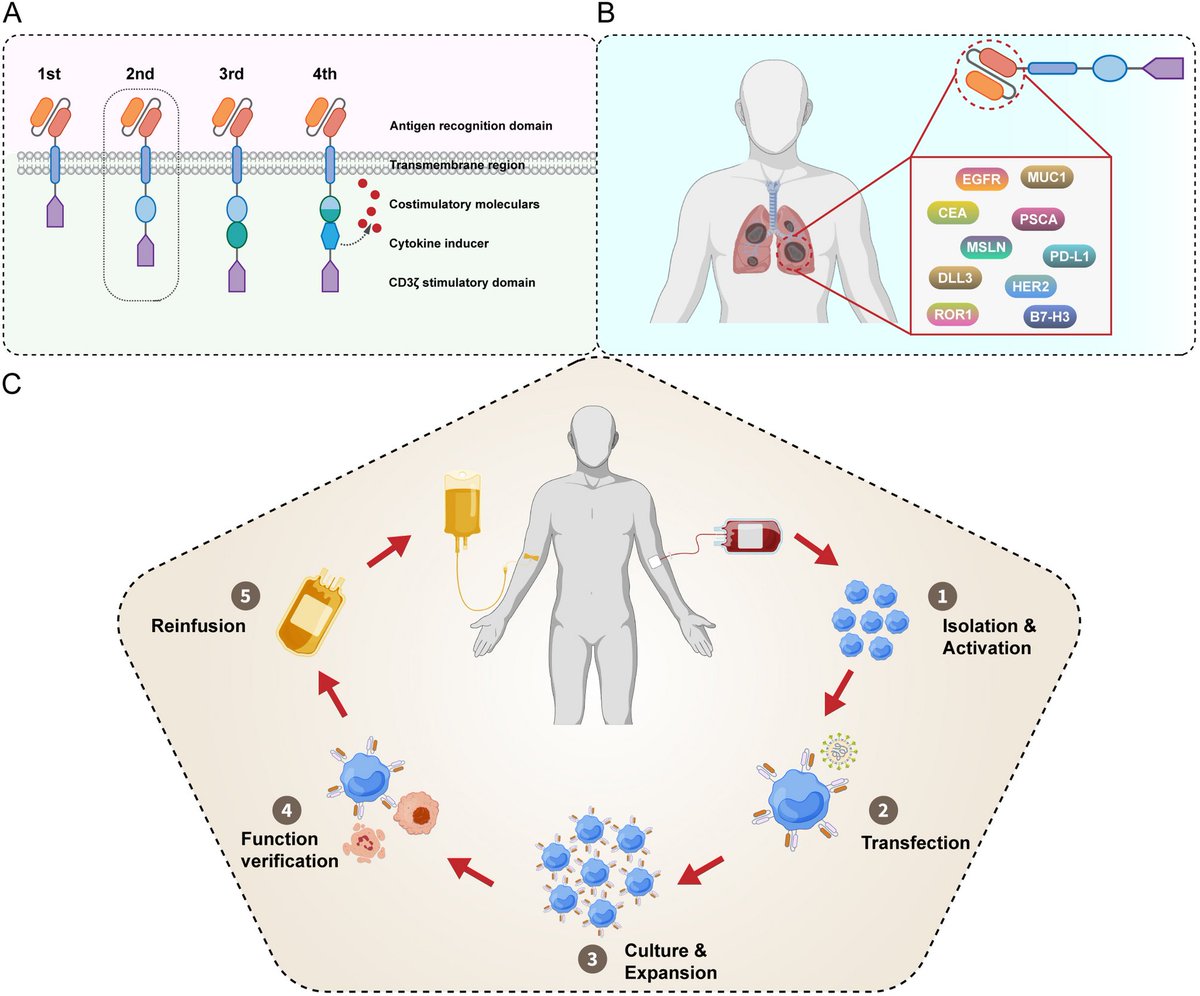 This #review summarizes recent advances and challenges in cell-based immunotherapies for #LungCancer.

📍Read it here: bit.ly/4lQiUa3