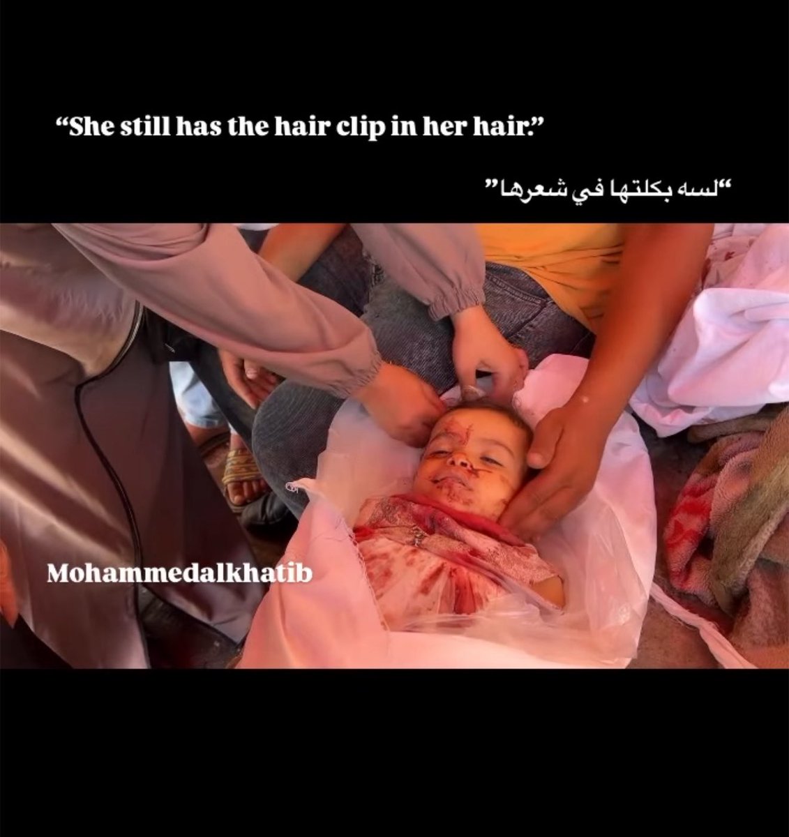 “She still has the hair clip in her hair.”💔