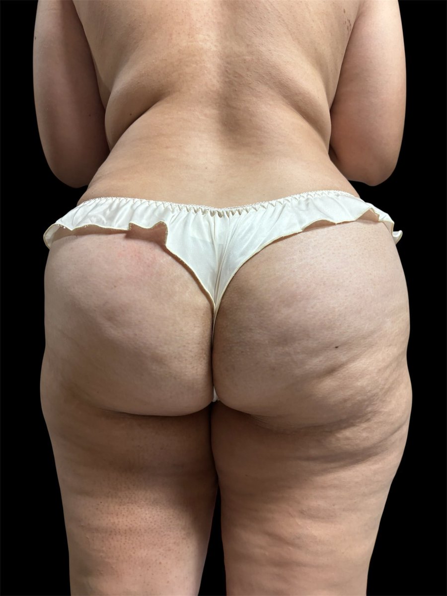 กกนใหม่ ติชมได้ครับ