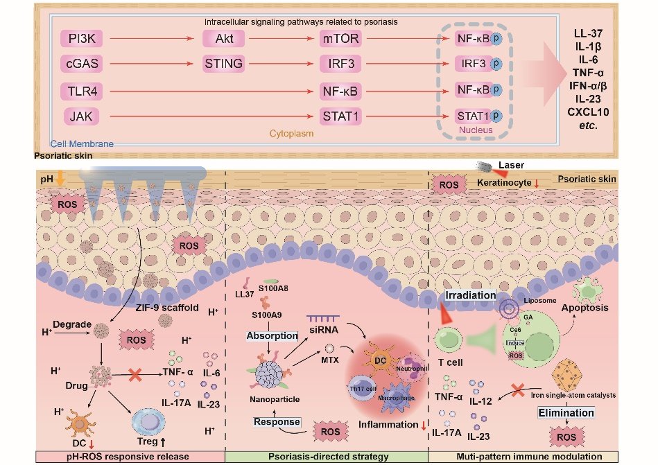New review article explores recent advancements in nanomedicine for psoriasis, highlighting potential for targeted, effective treatments with fewer side effects！👇
#nanomedicine 
<a href="/BiomedNano/">Nano Biomed. Eng.</a> <a href="/SciOpenTUP/">SciOpenTUP</a> 
sciopen.com/article/10.265…