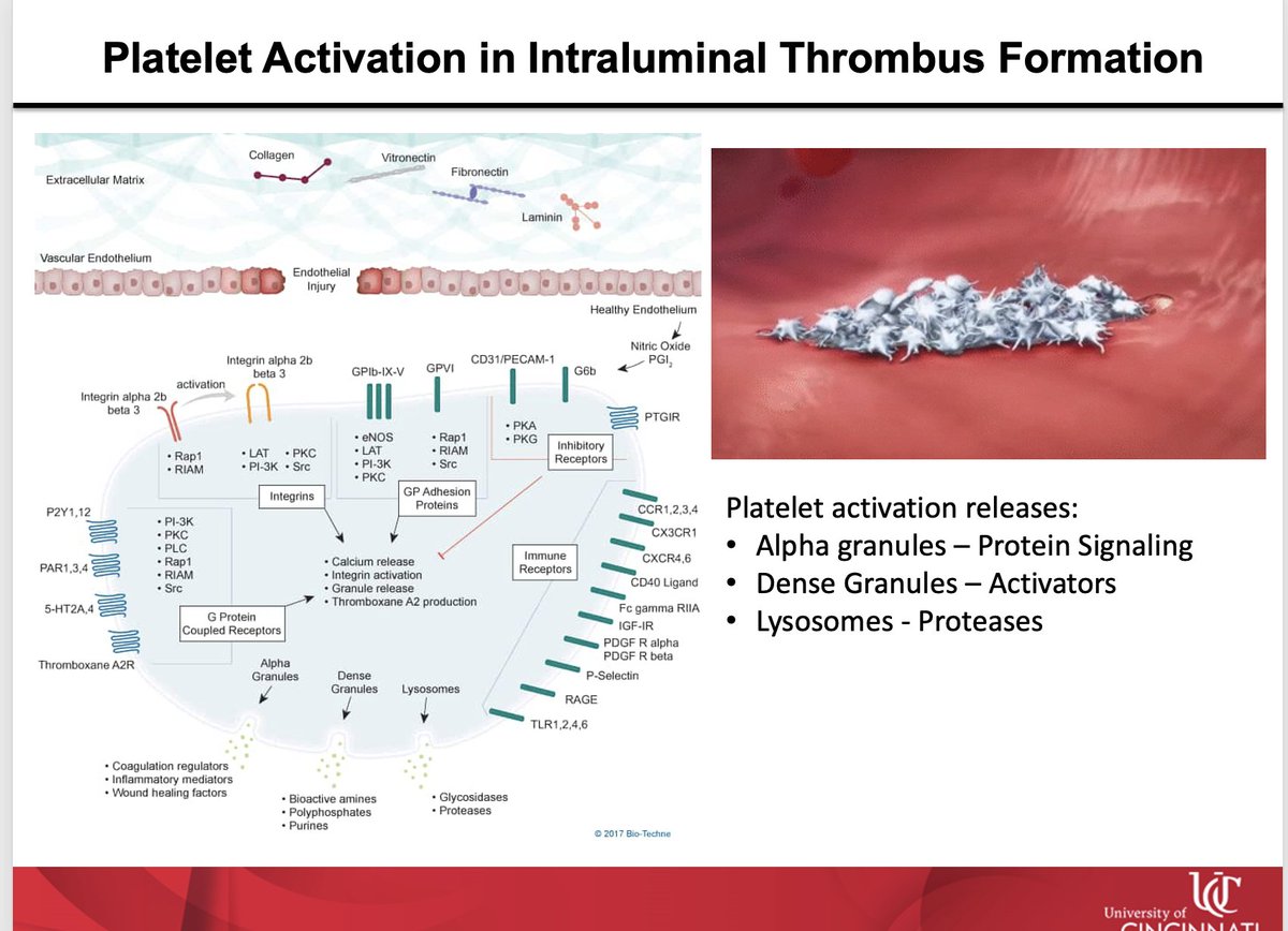 2Scottish's tweet image. Terrific visiting professor seminar from my long time collaborator and good friend @Phil_OwensCincy !  Lot to do with @drseanlyden and Stan Hazen (not on Twitter-X).   Big #AortaEd📜coming online soon ! @ThinkAorta @ThinkAortaUS
