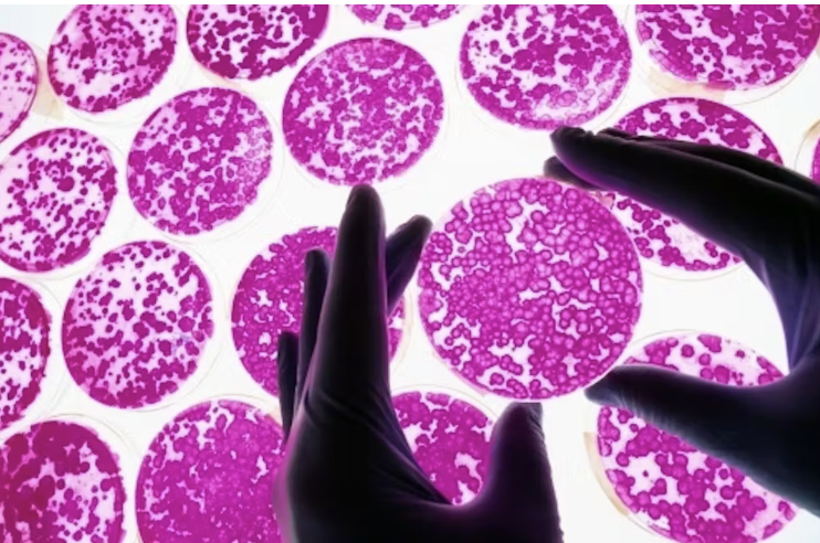 ｢心臓や肺を「元に戻せる薬」の治験が視野に　再生医療の最前線｣
 
･ 「あと2〜3年で、肺や心臓の損傷を回復させられるようになる可能性がある」シュルツ氏
･ 薬で臓器の幹細胞を刺激
･ 心臓発作後のブタの心臓の修復に成功
･ ヒトでの臨床試験は2027年に開始予定
 
nikkei.com/article/DGXZQO…