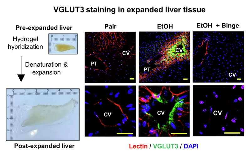 Hepatic Cell News (@hepaticcellnews) on Twitter photo A new study in <a href="/NatureComms/">Nature Communications</a> highlights the role of glutamate storage and release in mediating alcohol-related #steatohepatitis.
go.nature.com/44yMRWp A new study in <a href="/NatureComms/">Nature Communications</a> highlights the role of glutamate storage and release in mediating alcohol-related #steatohepatitis.
go.nature.com/44yMRWp