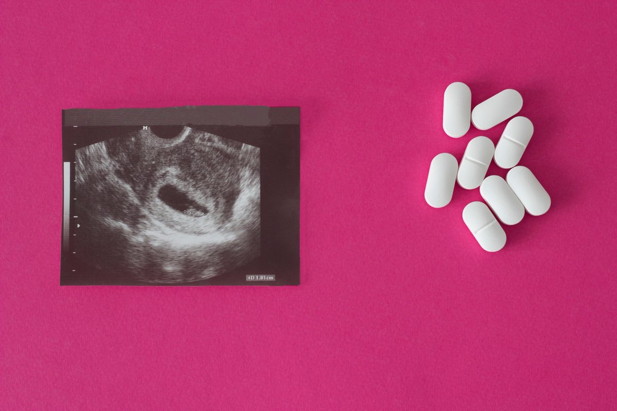 News Medical (@newsmedical) on Twitter photo New evidence urges caution with TMP-SMX antibiotics in early pregnancy, highlighting safer options for treating urinary tract infections. news-medical.net/news/20250710/… <a href="/JAMANetworkOpen/">JAMA Network Open</a> New evidence urges caution with TMP-SMX antibiotics in early pregnancy, highlighting safer options for treating urinary tract infections. news-medical.net/news/20250710/… <a href="/JAMANetworkOpen/">JAMA Network Open</a>
