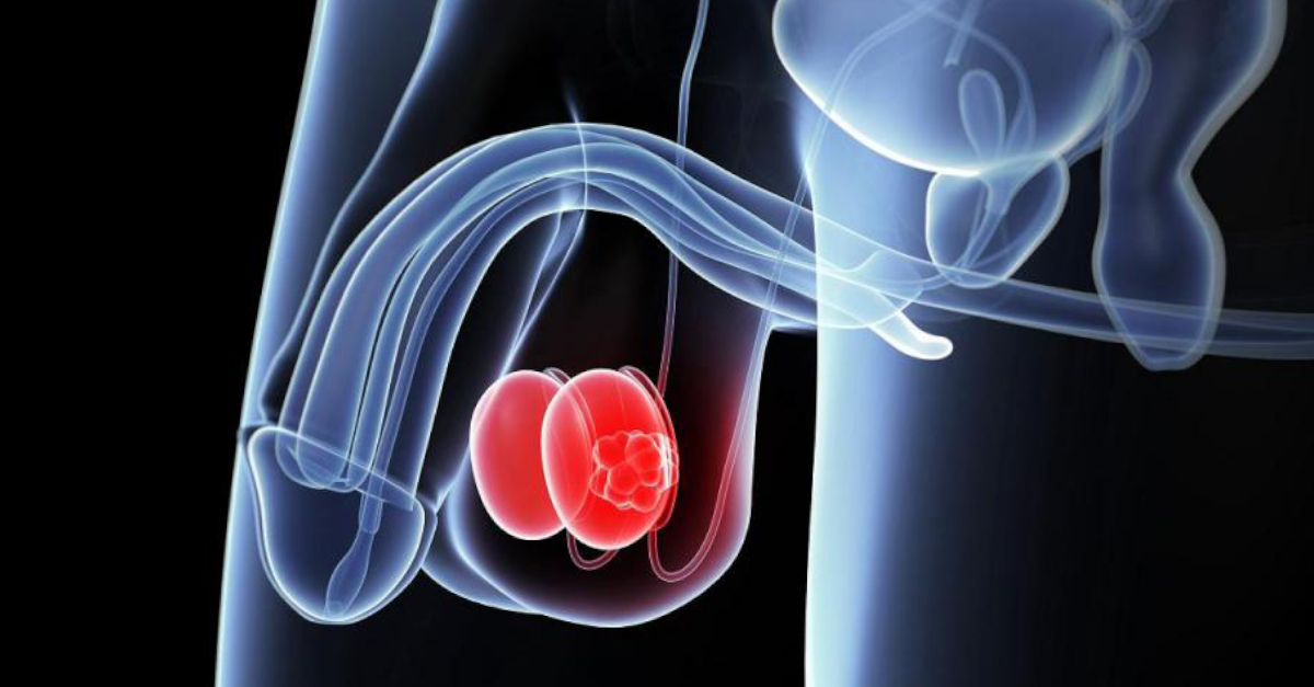 Testicular Cancer: EAU
ms.spr.ly/6013SfRhL