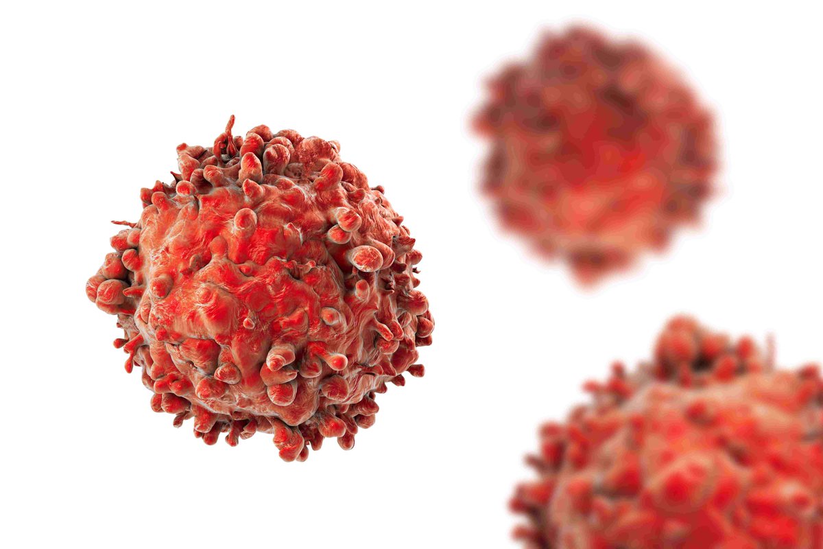The IMJ (@the_imj) on Twitter photo IMJ July 2025 #OpenAccess
Original Article: Allogeneic haemopoietic stem cell transplantation for patients with chronic lymphocytic leukaemia
bit.ly/3Iltfw0
<a href="/TheRACP/">The Royal Australasian College of Physicians</a> <a href="/WileyHealth/">Wiley Clinical Health</a> IMJ July 2025 #OpenAccess
Original Article: Allogeneic haemopoietic stem cell transplantation for patients with chronic lymphocytic leukaemia
bit.ly/3Iltfw0
<a href="/TheRACP/">The Royal Australasian College of Physicians</a> <a href="/WileyHealth/">Wiley Clinical Health</a>
