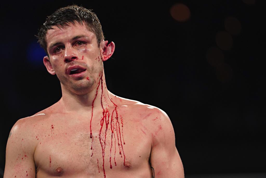 Liverpool’s Stephen Smith was forced to undergo immediate medical attention as surgeons worked to save his ear following a severe slash in 2017 #boxraw