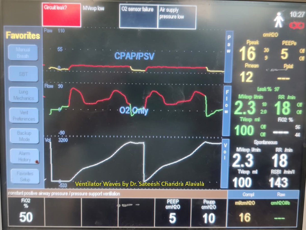 How would you interpret the following waveforms?
#mechanicalventilation 
#ventilatorwaves