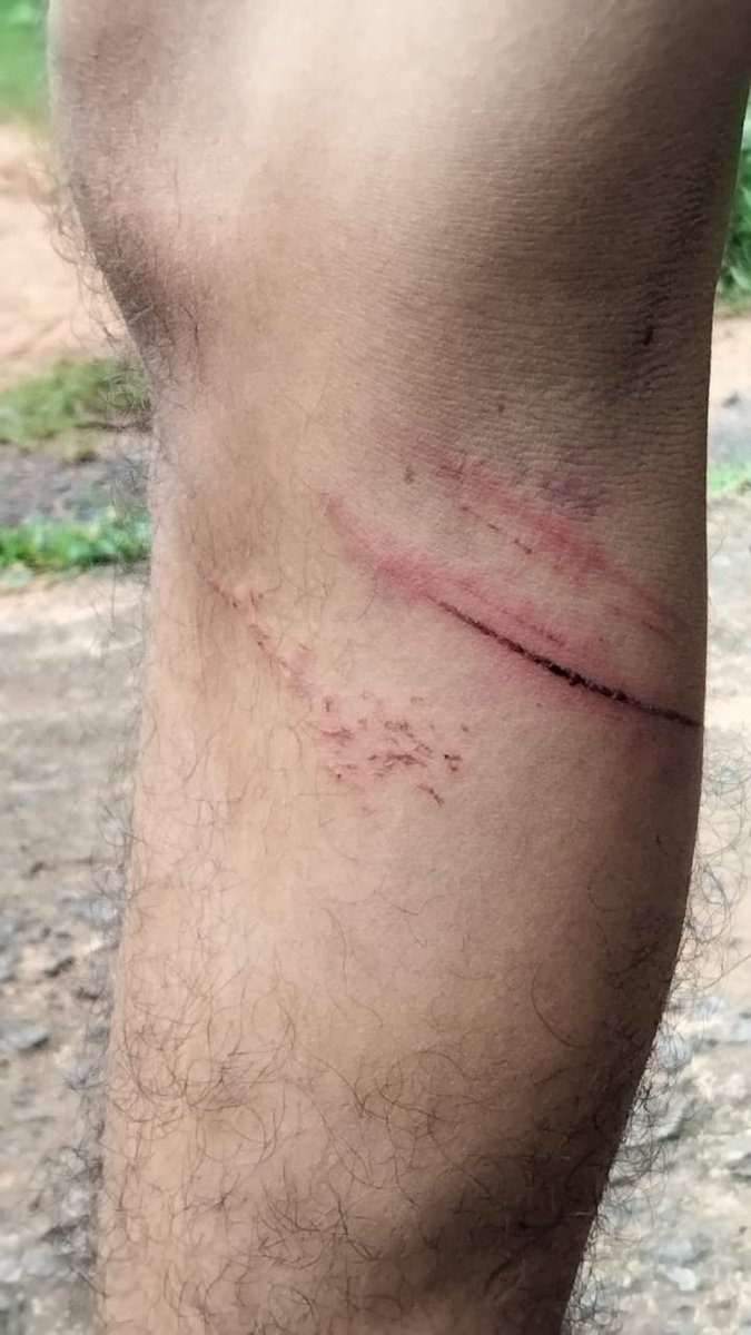 SamirulAITC's tweet image. This is why we call the BJP anti-Bengali. We have never viewed the atrocities against migrant workers through the lens of religion. But now, BJP’s @SuvenduWB has claimed that Bengali-speaking migrant workers from this state are Rohingyas.
Let me give an example to show this…