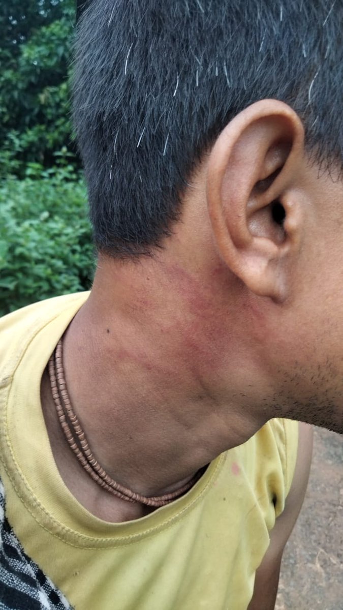 SamirulAITC's tweet image. This is why we call the BJP anti-Bengali. We have never viewed the atrocities against migrant workers through the lens of religion. But now, BJP’s @SuvenduWB has claimed that Bengali-speaking migrant workers from this state are Rohingyas.
Let me give an example to show this…
