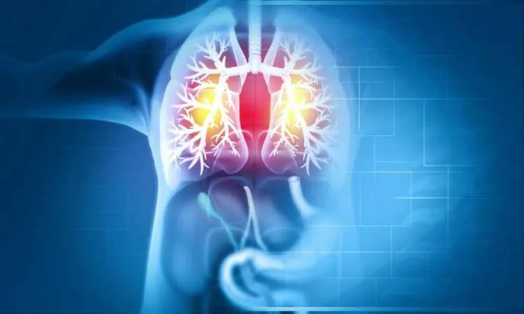 Drug Discovery World (@ddwjournal) on Twitter photo Merck acquires Verona, expands cardio-pulmonary portfolio
ddw-online.com/merck-acquires…
#DrugDiscovery Merck acquires Verona, expands cardio-pulmonary portfolio
ddw-online.com/merck-acquires…
#DrugDiscovery