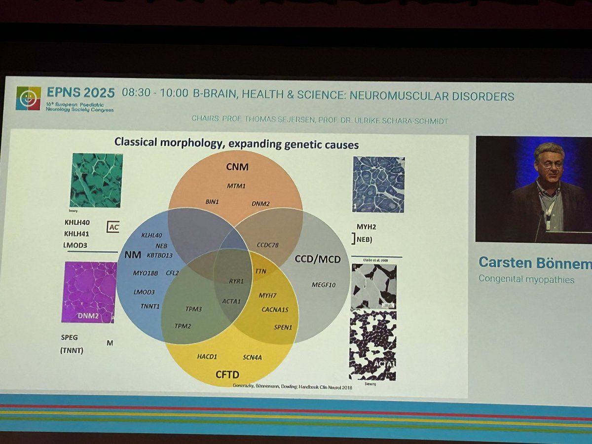 Genetic causes of neuromuscular disorders