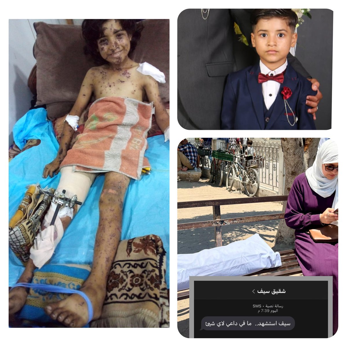 amalhabeeb87's tweet image. إلى سيف كشكو!
وجدت نفسي أريد الكتابة إليك، لا أدري لماذا، لكنني فعلت.
أبكيك أنا، أبكي جراحنا كلها، أطراف أطفالنا المبتورة، أفكّر في كل مصاب فينا كان من الممكن أن تشرق عليه شمس اليوم لكنّه غاب، لأن واقعنا الصحي قد انهار فعلًا ولا دواء إلا الرحيل!
هل سكن الألم يا سيف؟، هل توقف…