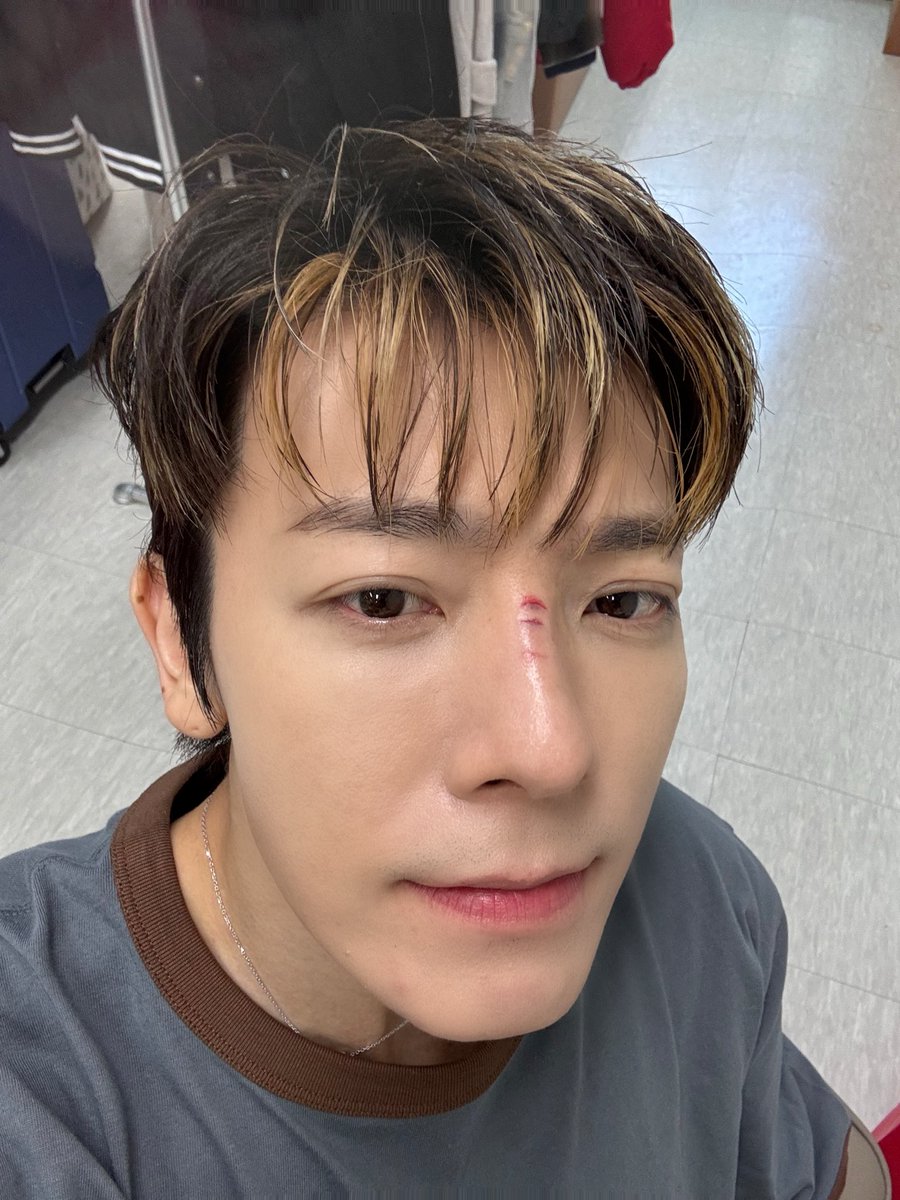 이정도면 빨대갖고 장난친것 같은데…뭔일이여ㅠ
