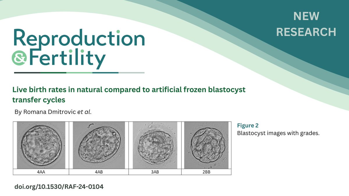Repro_Fertility's tweet image. Which method leads to better outcomes in #FrozenEmbryoTransfer (FET) - natural or artificial cycle?
New research by Romana Dmitrovic et al. suggests natural cycle FET may offer higher live birth rates, though other factors also play a role.
🔗doi.org/10.1530/RAF-24…