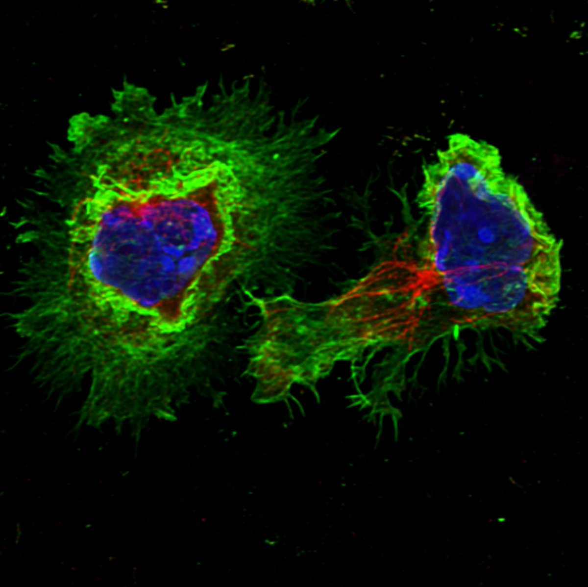CRUK_CI's tweet image. New research published today by the Institute's de la Roche Group is shining a light on why some cancer drugs have been underperforming in clinical trials.
This knowledge opens new opportunities for immunotherapies to be made more effective.
cruk.cam.ac.uk/news/new-clue-…