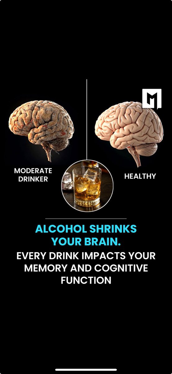 Large-scale MRI studies published in Nature Communications and BMJ reveal that even moderate alcohol consumption can lead to brain shrinkage.
The study warns that no level of alcohol is entirely “safe” for brain health, challenging the notion of a harmless occasional drink