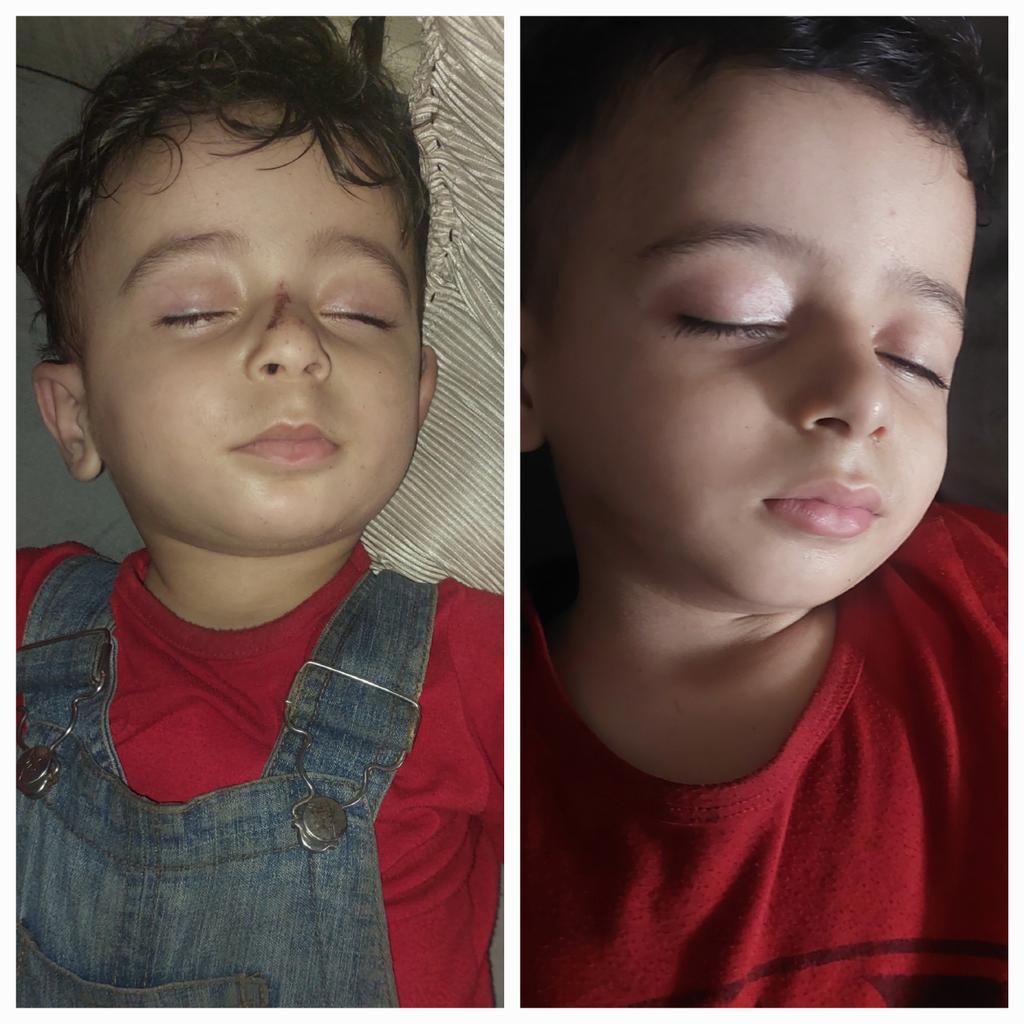 Mohammed|مُحَمّدْ𓂆🇵🇸 (@mhmd_harbeed) on Twitter photo chuffed.org/project/130240
Are you waiting for the next tweet to be the announcement of their death?
The price of a bag of flour has reached $1,000.
My children went to sleep in tears from hunger, hoping to wake up to a bite of food.
We will never forgive those who caused their chuffed.org/project/130240
Are you waiting for the next tweet to be the announcement of their death?
The price of a bag of flour has reached $1,000.
My children went to sleep in tears from hunger, hoping to wake up to a bite of food.
We will never forgive those who caused their