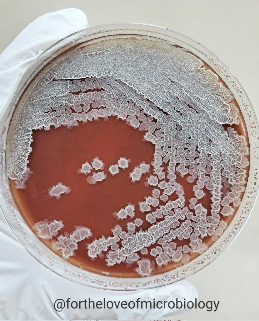 fortheloveofmi2's tweet photo. Bacillus subtilis colony on chocolate agar showing characteristic large, spreading, and wrinkled growth with a dry, ground-glass appearance. 

The colony exhibits lobate edges and a highly filamentous, frost-like surface—typical of motile Bacillus species. 

B. subtilis is a Gram-positive, spore-forming rod widely found in soil and the environment. Though typically considered non-pathogenic, it may occasionally be isolated in clinical specimens and should be interpreted with caution, particularly in immunocompromised patients or device-related infections.

#Fortheloveofmicrobiology #clinicalmicrobiology #mmidsp #microrounds #IDpath #ASMClinMicro #STEM #WomeninMicrobiology #ClinMicro #microbiologypakistan #PathBugs #crittersontwitter
