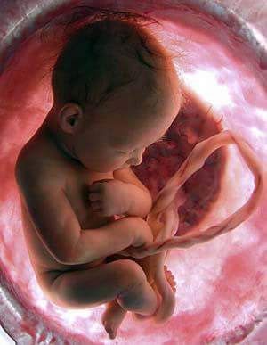 It’s a child, not a choice.