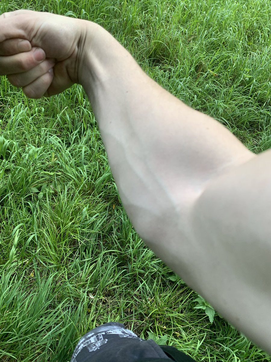 mpxdetka's tweet image. Права рука якось більше прокачується, цікаво чому ?🥲

#Vascular #MuscleGoals
#VeinPorn #ArmDay
#MuscleShot #VeinGoals
#FitnessMotivation #Strength