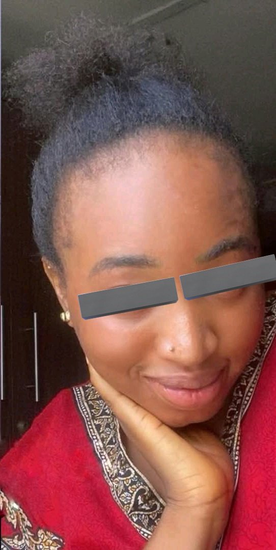 Frame 1: Before

Frame 2: After

Skincare is rubbish, doesn't work 😐