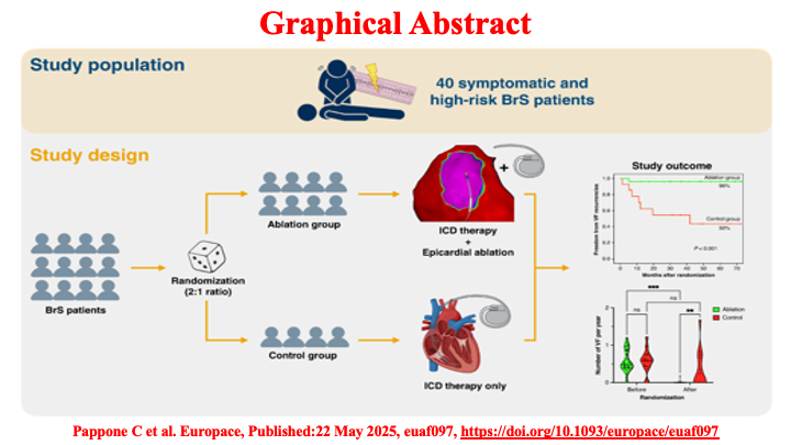 drraviele's tweet image. 📌 High-risk #BrugadaSyndrome random. trial
👉 Epicardial #ablation + ICD assoc. w/ ⬇️ in VF recurrence compared w/ #ICD alone
#EPeeps #suddendeath #ECG #CardioTwitter #MedTwitter @DrRoderickTung @Dr_Santangeli @DoctorPhillEP @drluissaenz @ftrae @SeguraCardio @LluisMont2 @Hragy